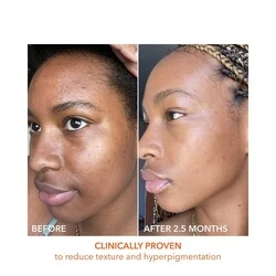 Dr Dennis Gross Alpha Beta Universal Daily Peel - Image 5